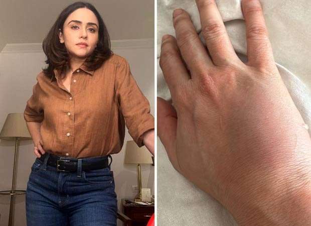 Amruta Khanvilkar recalls injury during intense Taskaree action shoot: “My wrist remained swollen for over a month” : Bollywood News - Bollywood Hungama