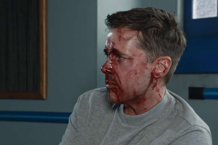 A badly beaten and bloody Todd sits in the police interview room in Coronation Street