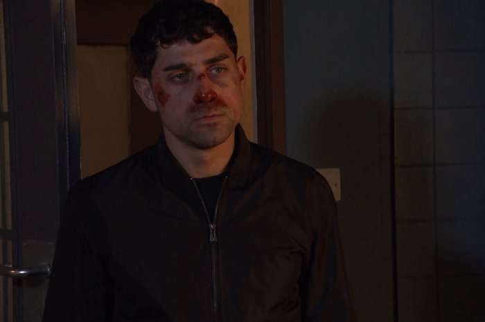 Jenson with a bloodied face in a scene from Hollyoaks